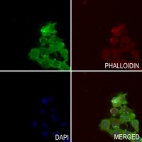 Anti-TAK1 (Phospho-T184) Antibody
