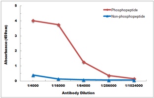 Anti-TAK1 (Phospho-T184) Antibody