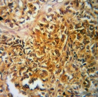 TAU (Phospho-T522) Antibody