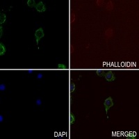 Tau antibody