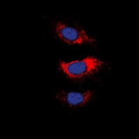 MARCKS antibody