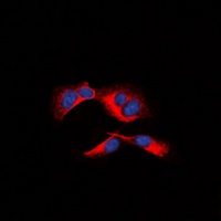 Anti-MCL1 (Phospho-S159) Antibody