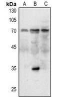MDM2 Antibody
