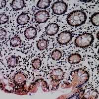MDM2 Antibody
