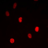 Anti-TRAP100 Antibody
