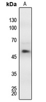 MEF2A (Phospho-T312) Antibody