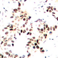 MEF2A (Phospho-T312) Antibody
