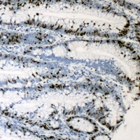 Anti-MKI67IP Antibody