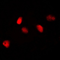 Anti-MKI67IP Antibody