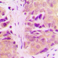 Anti-MRPL18 Antibody