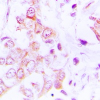 Anti-MRPL49 Antibody