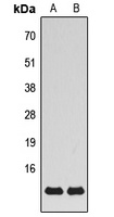 MRPS21 Antibody