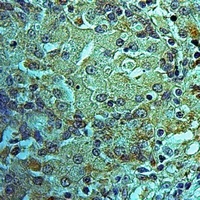 Anti-MRPS25 Antibody