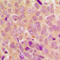 Anti-Ezrin/Radixin/Moesin (Phospho-T567/564/558) Antibody