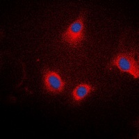 Anti-Ezrin/Radixin/Moesin (Phospho-T567/564/558) Antibody