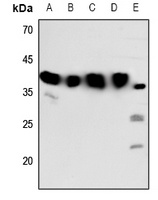Melatonin Receptor 1b Antibody