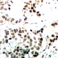 Anti-c-Myc (Phospho-T358) Antibody