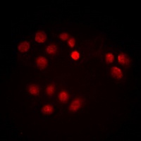 c-Myc (Phospho-T358) antibody