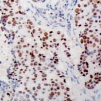 c-Myc Rabbit Polyclonal Antibody