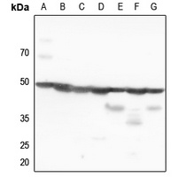 p47 phox Antibody