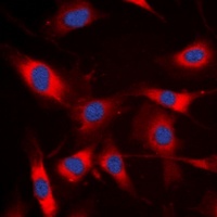 Anti-p47 phox Antibody