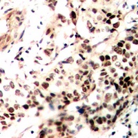 Anti-SMRT Antibody
