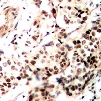 SMRT antibody