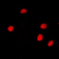 Anti-SMRT Antibody