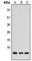 NDUFS5 Antibody