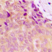 Anti-NDUFS5 Antibody