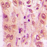 Anti-NFAT3 Antibody