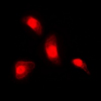 Anti-NFAT3 Antibody
