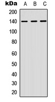 NFAT3 Rabbit Polyclonal Antibody