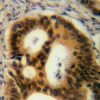 NFAT3 Rabbit Polyclonal Antibody