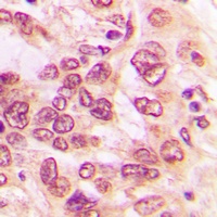 NF-kappaB p105 (Phospho-S893) Rabbit Polyclonal Antibody