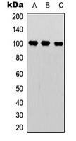 NF-kappaB p100 Antibody