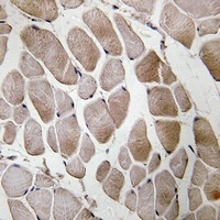 Anti-Neuromedin U Antibody