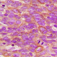 Anti-TRK A (Phospho-Y496) Antibody