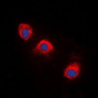 Anti-TRK A (Phospho-Y496) Antibody