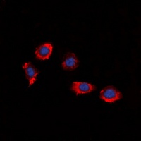 Anti-P2Y8 Antibody