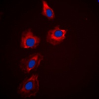 PAK1/2/3 antibody