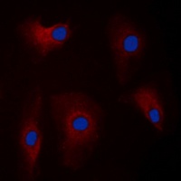 Parkin antibody