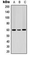 PDCD4 (Phospho-S67) Antibody