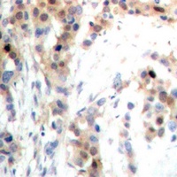 Anti-PDCD4 (Phospho-S67) Antibody