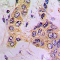 Anti-PDPK1 Antibody
