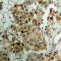 Progesterone Receptor (Phospho-S190) Antibody