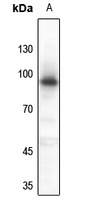 Progesterone Receptor Rabbit Polyclonal Antibody