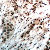 Anti-Progesterone Receptor Antibody