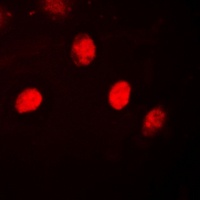 Anti-Progesterone Receptor Antibody