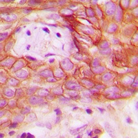 Anti-KEPI Antibody